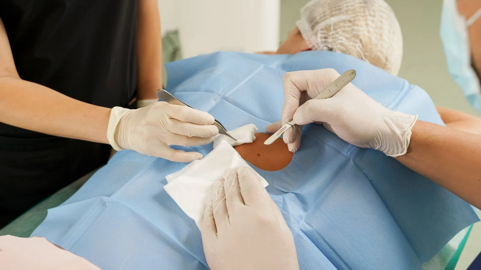 Advanced Oncosurgeries with Post-Surgery Integrative Care